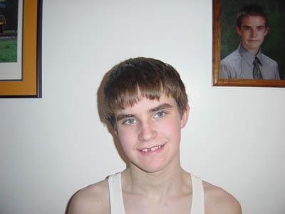 Jason looses his front tooth in Freshmen Basketball